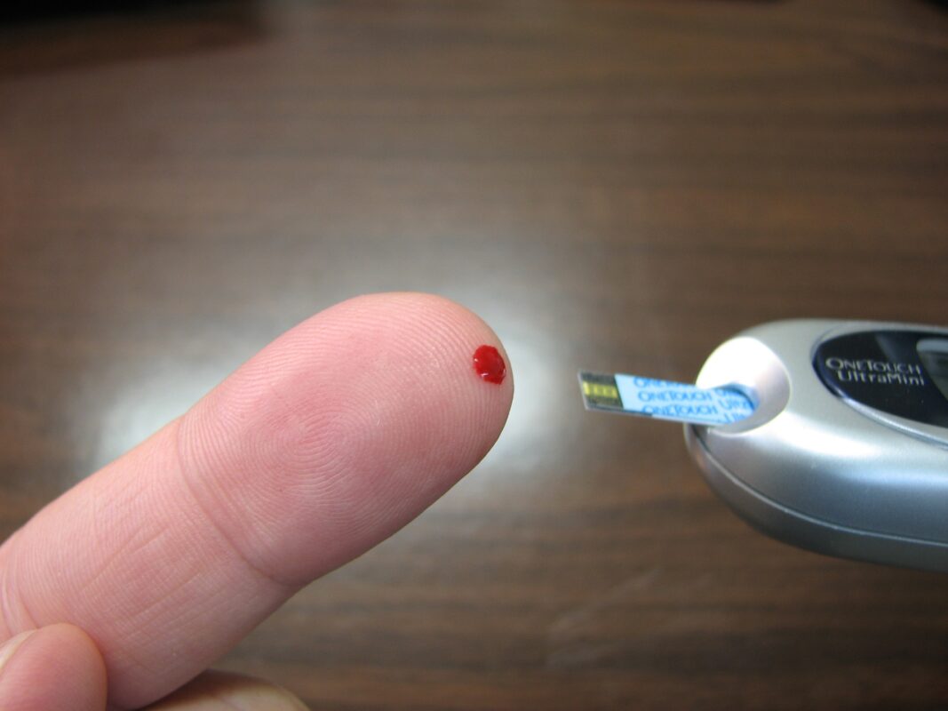 Cukrovka (Diabetes): Jak se léčí, co jíst a co nejíst?